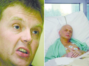 ����˹ǰ�ع�����ά����ж�ǰ���󣩺��ң���ƴ����Ƭ